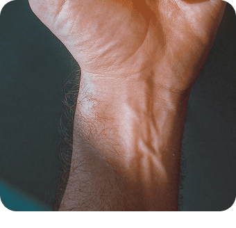 Close-up of a wrist against a dark background