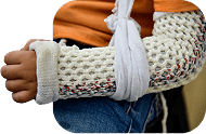 Arm in a mesh cast and sling